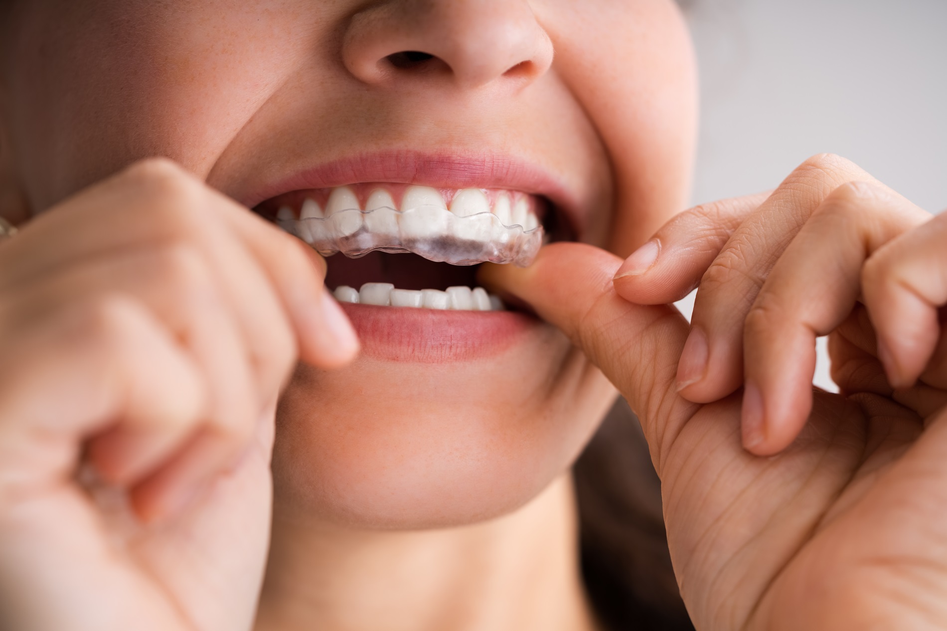 Experienced dentist in Barnes offering TMJ treatment